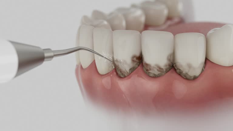 Trusted Dental Implants service in Gore, OK - Dentist Open Now
